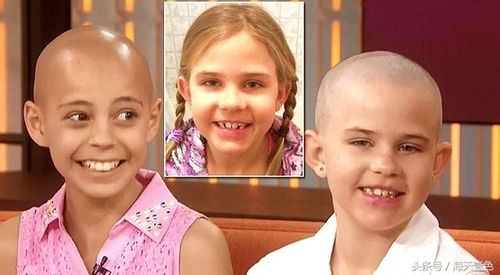 女孩谎称生病剃光头 外公为陪她毅然剃光头发