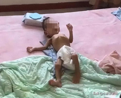 父亲回应女婴被饿成皮包骨进ICU：家庭矛盾与爱心的碰撞