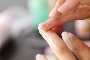 指甲不平整，真的等于营养不良吗？