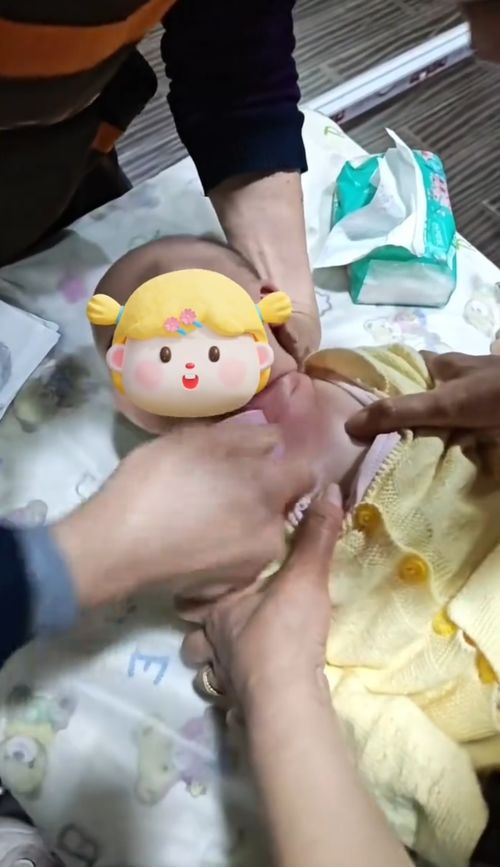 婴儿刮痧真的安全吗？成都事件引发的深思