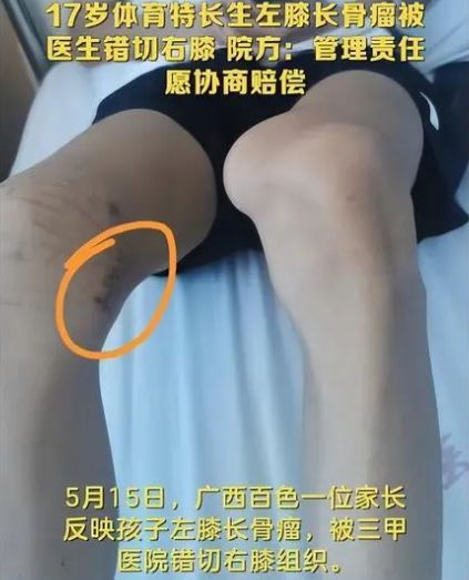 17岁体育生被错切右膝，母亲拒绝和解：医疗事故背后的辛酸与坚持