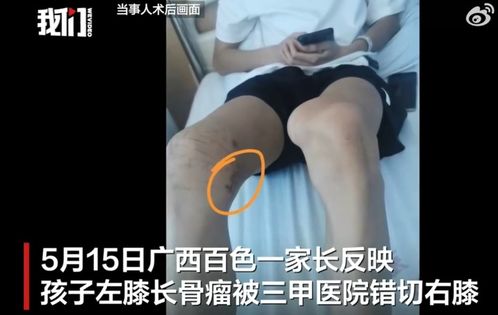 体育生被错切右膝，母亲坚决不接受和解，真相令人痛心