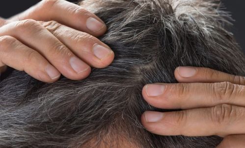 你长白头发了吗？白发与身体的关系，后悔知道太晚了