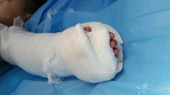 浙江医生举报3岁男童疑遭生父虐待，多处撕裂骨头露出，警方已介入调查