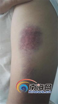 博主买鱼拒杀遭暴力殴打：事件背后的人性与法律思考