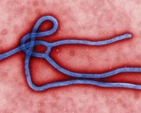 1岁宝宝因“狂亲”感染EB病毒，家长需警惕这些行为！