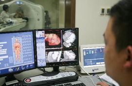 CT检查真的会引发癌症吗？这些风险你必须知道