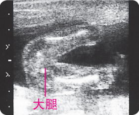 48岁妈妈怀孕7个月才被发现：女儿的复杂心情与家庭的新篇章