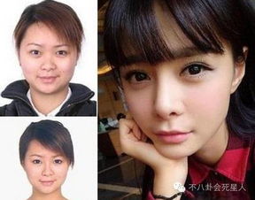 35岁女子月入5万，北漂十几年却只攒下10万：整容10年花80多万背后