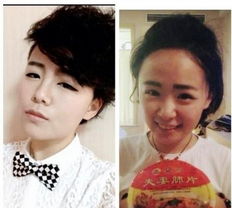 毕夏术后恢复照片曝光