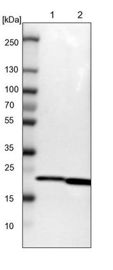 Western blot 图像对比示意图