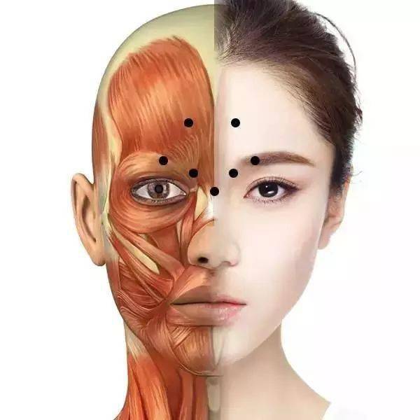 肉毒素注射过程