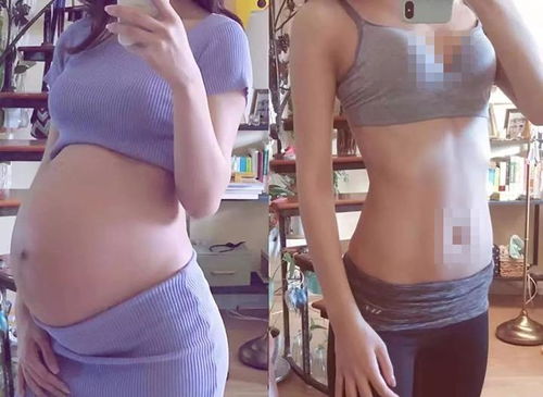 生娃后长高3cm？佛山宝妈意外走红，医生揭秘真相！