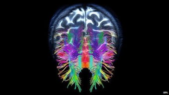 实验室中的大脑模型