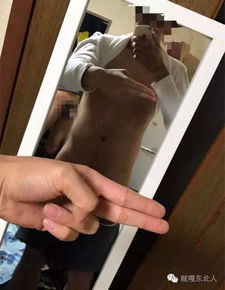 狐臭VS汗臭：如何准确区分两者并采取有效措施