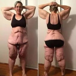 减肥对人的容貌影响有多大？从皮肤到气质，真实改变令人震撼