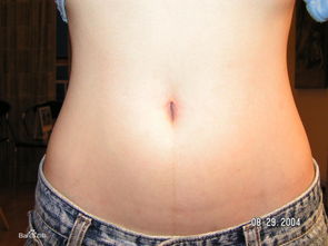 蓝莓“肚脐眼”有霉菌？食用后轻则拉肚子，重则中毒！我亲身经历告诉你真相