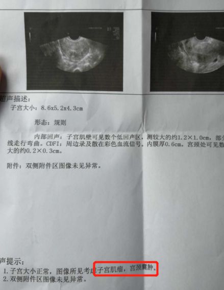 男子体检发现子宫肌瘤？医院通报引热议，真相竟出乎意料！