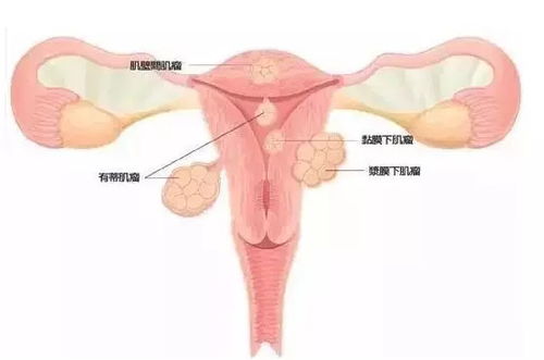 多家医院论文称男性患子宫肌瘤，涉学术造假？网友炸锅了！