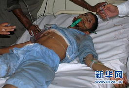 微创狐臭治疗过程