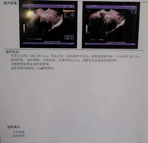 《中国医药指南》论文现荒唐数据：男性竟成子宫肌瘤患者，编辑被辞引热议