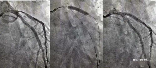刚刚显影成功的撕拉片特写画面