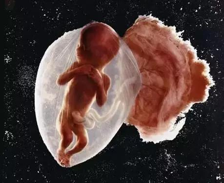 撕拉片显影过程特写照片