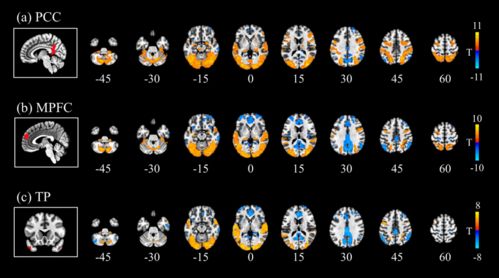 大脑在放空时的秘密：原来我们思考的不止是当下