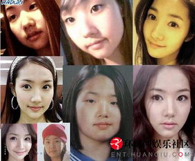 某女演员整容前后对比图