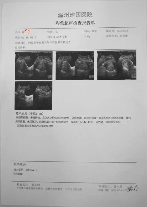 女性在看检查报告