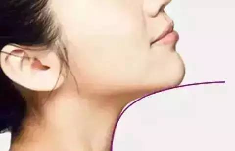 森碟近期照片下巴线条改善明显