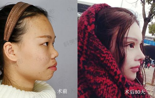 森碟下巴后缩改善了很多，田亮回应引热议！家长该长点心了