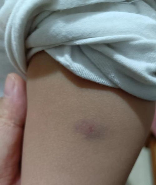 她记得我脚上的疤！内蒙古女子寻家26年母亲节前夕与生母相见