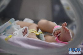 双胞胎婴儿躺在保温箱中