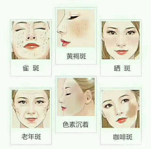 长斑了？我的护肤救赎之路，从焦虑到自信的转变