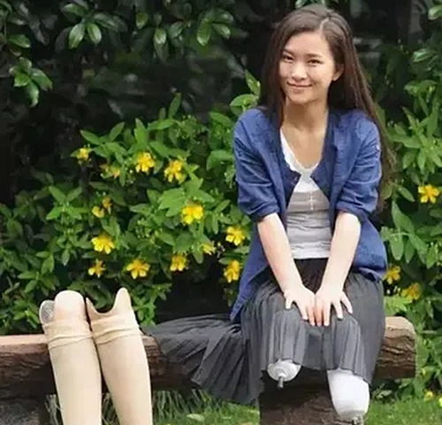 汶川地震失去双腿的她，如今用假肢跳出人生最美的舞步