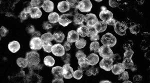 显微镜下的食脑虫图片