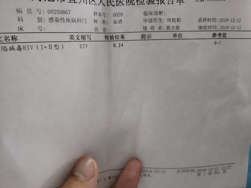 女性拿着孕检报告单