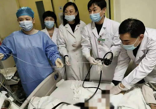 医生晒出18颗一模一样胆结石！网友：这到底是怎么长的？