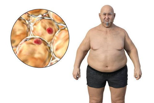 35岁工程师患胃癌晚期，家中3人有胃癌｜警惕遗传与生活习惯的双重风险