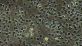 链霉菌在显微镜下的形态图