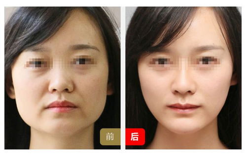 不良习惯对面部的影响