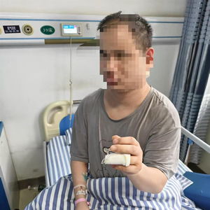 盲人体验小米SU7手指骨折？真实事件背后引热议