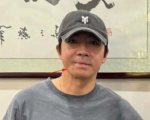 俞灏明王晓晨结婚 晒钻戒｜从情侣戒到疑似登记照，这对CP终于要修成正果？