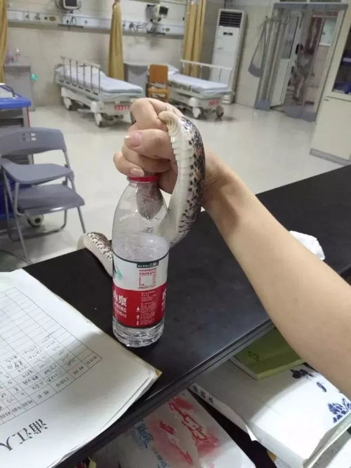 被蛇咬伤急救示意图