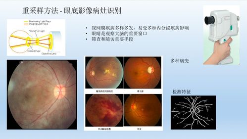 为什么X光检查越来越少，CT、核磁却越来越多？医保局终于回应了！