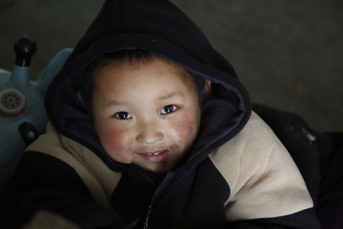 从自卑到自信：巨痣男孩的蜕变之路