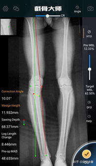 医生为病人检查骨科X光片