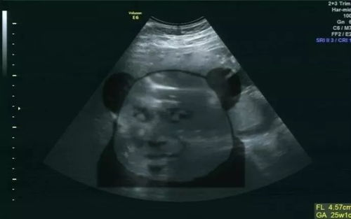 猪妈妈手持B超照片微笑