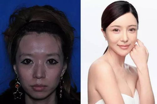 从金发碧眼到韩系甜妹，她全脸整容只为成为张元英？